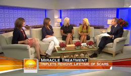 Play Video - Today Show - The Berns Triplets Scarred by Fire, treated by Dr Jill Waibel